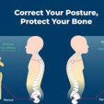 Bone Health and Osteoporosis