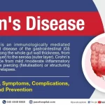 Definition & Facts for Crohn’s Disease