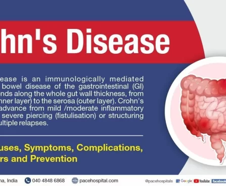 Definition & Facts for Crohn’s Disease