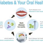 Diabetes and Oral Health