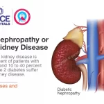 Diabetic Kidney Disease