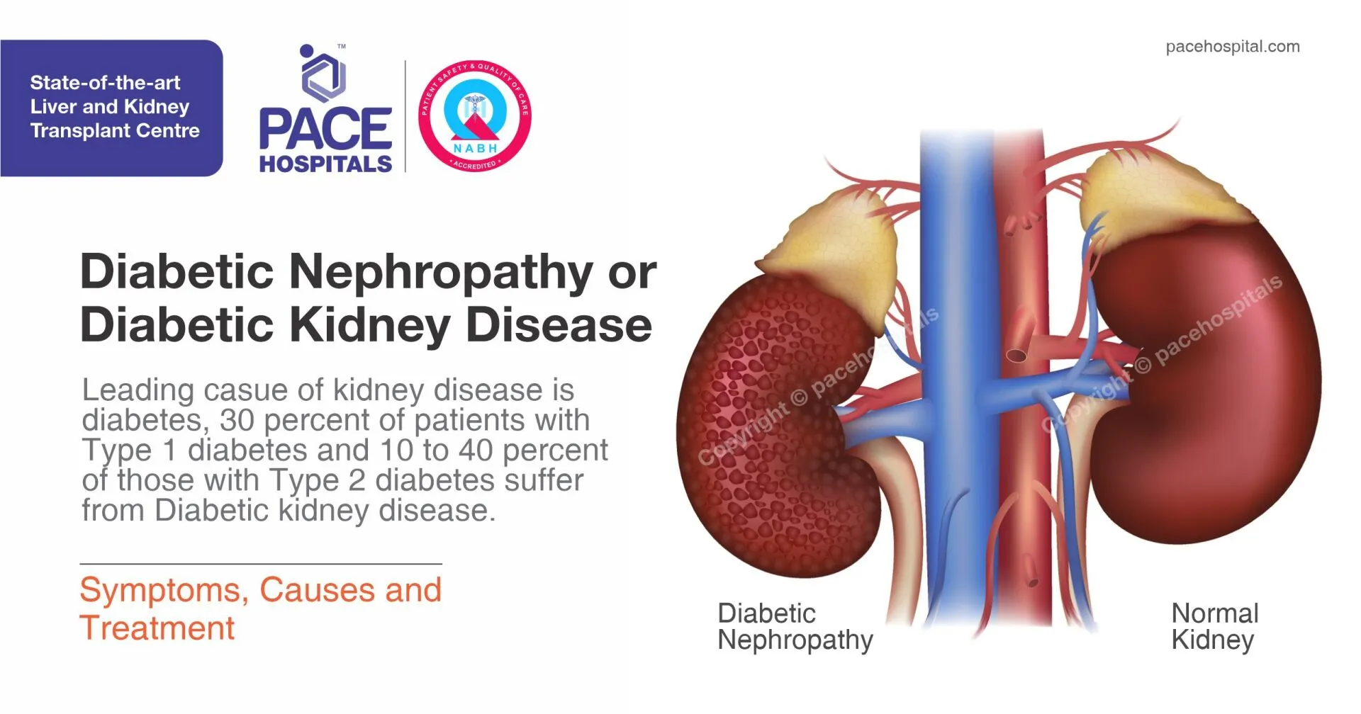 Diabetic Kidney Disease