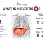 Hepatitis A