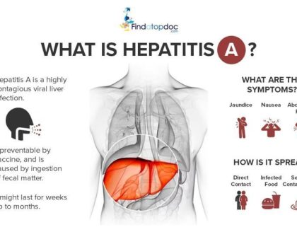 Hepatitis A