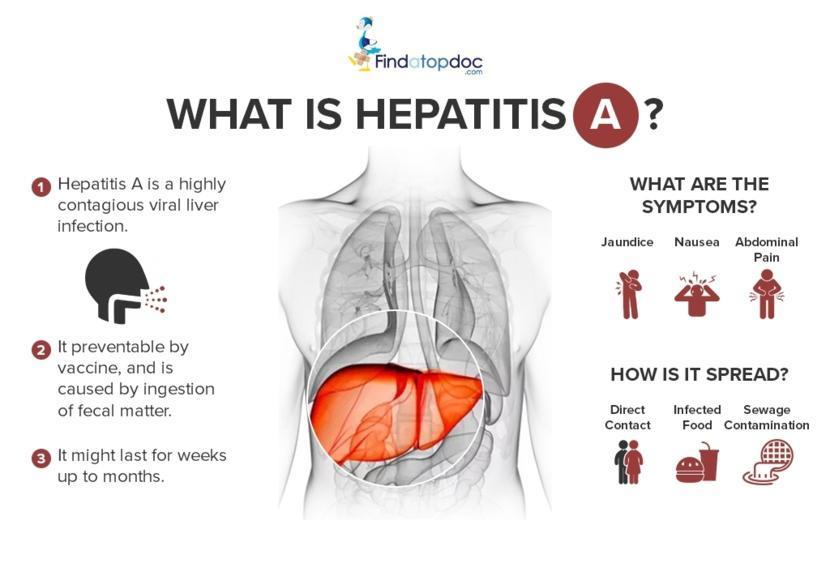 Hepatitis A