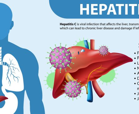 Hepatitis C